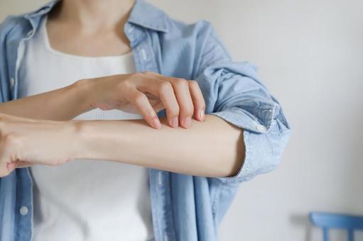 腕を掻く女性 腕を掻く女性 腕,手,掻くの写真素材