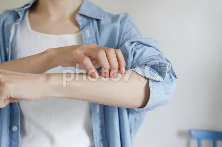 腕を掻く女性 腕,手,掻くの写真素材