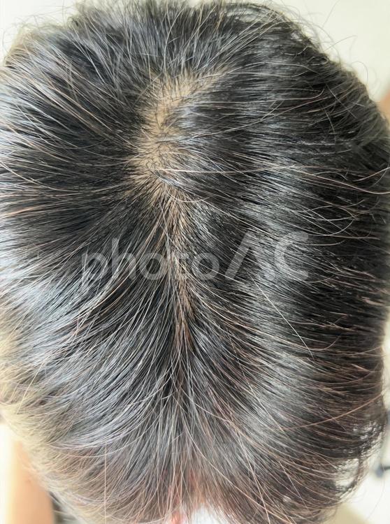 つむじや分け目が気になる年齢ヘアケア悩み 頭頂部,髪,つむじの写真素材