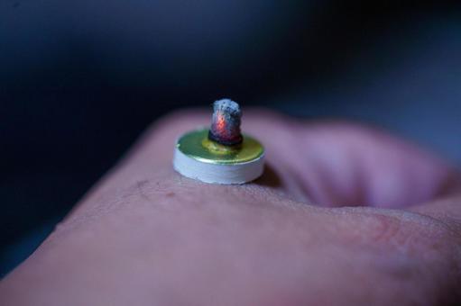 ツボへのお灸で体調を整える ツボへのお灸で体調を整えるの写真