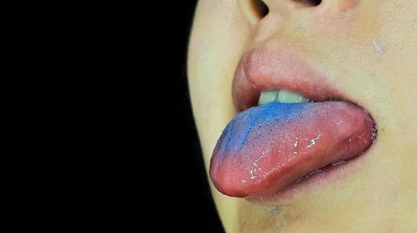 青い舌 青い舌の写真