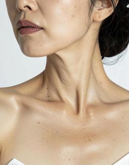 デコルテの色素沈着の写真