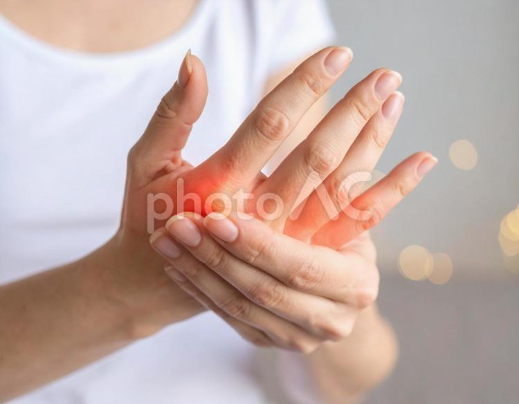 手指の関節痛 リウマチ,手指,関節痛の写真素材