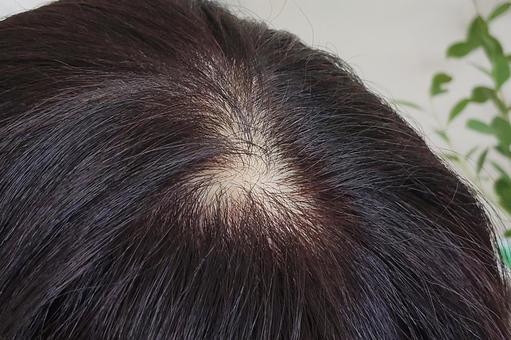薄くなった頭頂部に毛が生えますように 薄くなった頭頂部に毛が生えますように 髪,頭,人物の写真素材