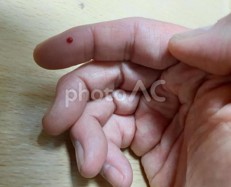 指の怪我　血 怪我,ケガ,傷の写真素材