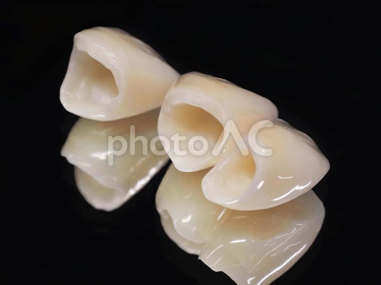 cadcam　オールセラミックス　内面 cadcam,セラミック,前歯の写真素材