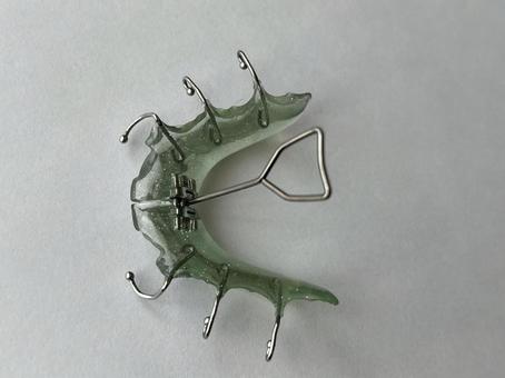 子どもの歯列矯正に使用する矯正装置 子どもの歯列矯正に使用する矯正装置 小児矯正,歯列矯正,子どもの写真素材