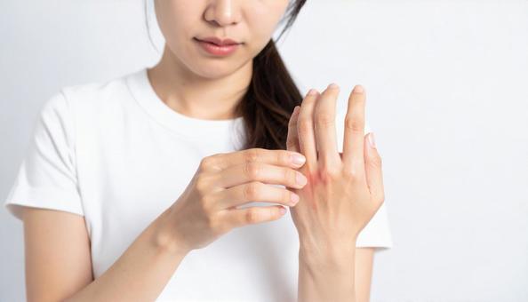 若い女性の手荒れイメージ 若い女性の手荒れイメージの写真