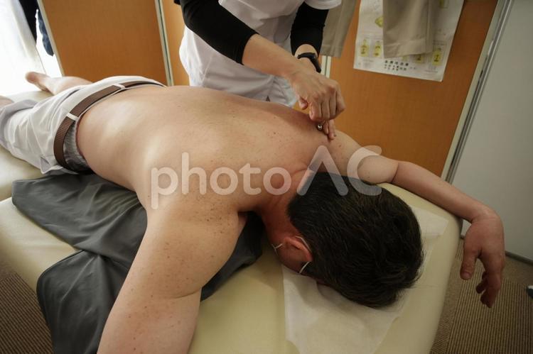 男性の施術風景 男性,背中,施術の写真素材