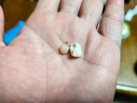歯が抜けました 歯が抜けました 子供,歯,歯が抜けたの写真素材