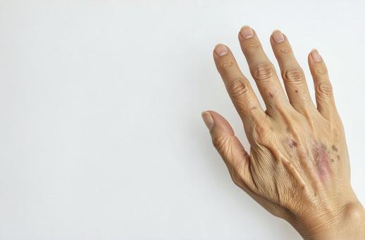 年齢肌の手元イメージ 年齢肌の手元イメージの写真