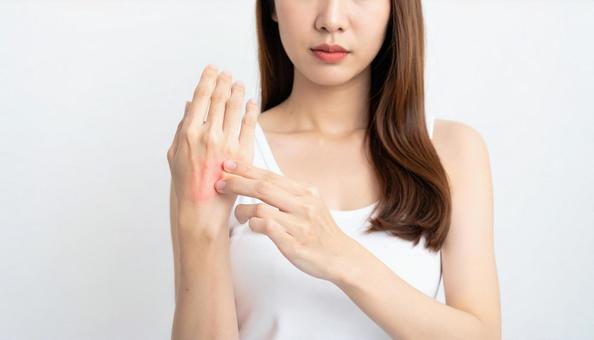 若い女性の手荒れイメージ 若い女性の手荒れイメージの写真
