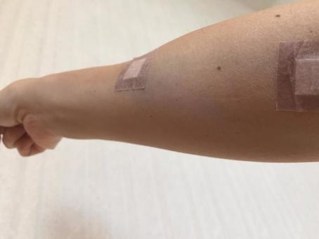 Photo, arm, hospitalization, hospital, 