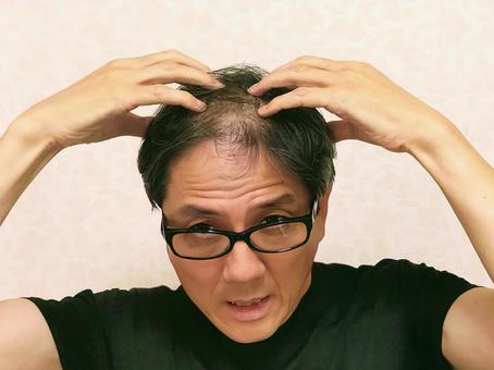 薄毛に悩む男性 薄毛に悩む男性 薄毛,悩む,男性の写真素材