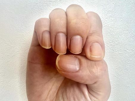 二枚爪の手指 二枚爪の手指 二枚爪,爪,手指の写真素材