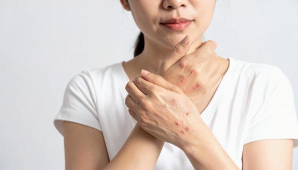 ミドル女性の手荒れイメージの写真