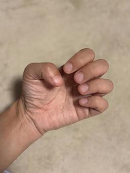 若い女性の深爪 若い女性の深爪 女性,深爪,ストレスの写真素材